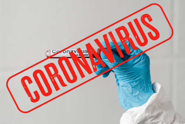 cropped view of person in latex glove holding blood sample, coronavirus illustration - Zdjęcie, obraz