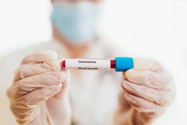 COVID-19 test e campione di laboratorio di esami del sangue per la diagnosi di nuova infezione da virus Corona - Foto, immagini