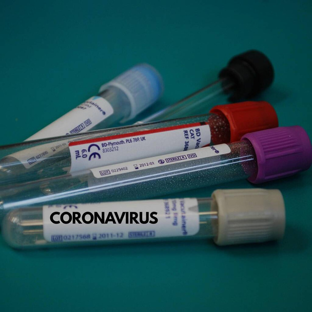 Photographie conceptuelle - Analyser en laboratoire des échantillons de sang de patients pour détecter la présence de coronavirus (COVID-19). Une main tient une éprouvette contenant un échantillon de sang qui a été testé pour le coronavirus
. - Photo, image