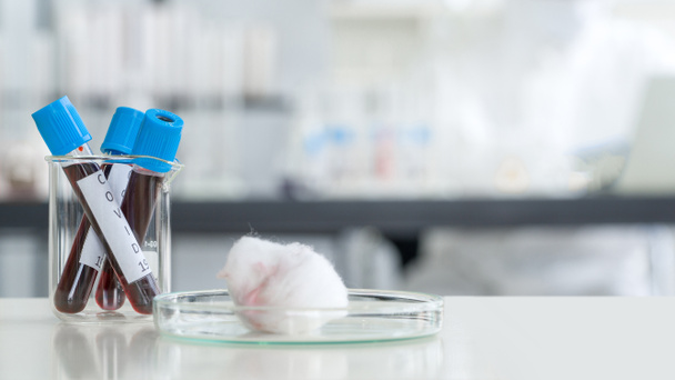 Beyaz bir laboratuvar masasında 19 hastadan kan toplama tüpleri.. - Fotoğraf, Görsel
