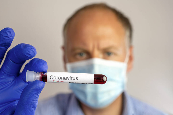 Un hombre serio usando máscara protectora y mostrando resultado positivo de su prueba de coronavirus
. - Foto, Imagen