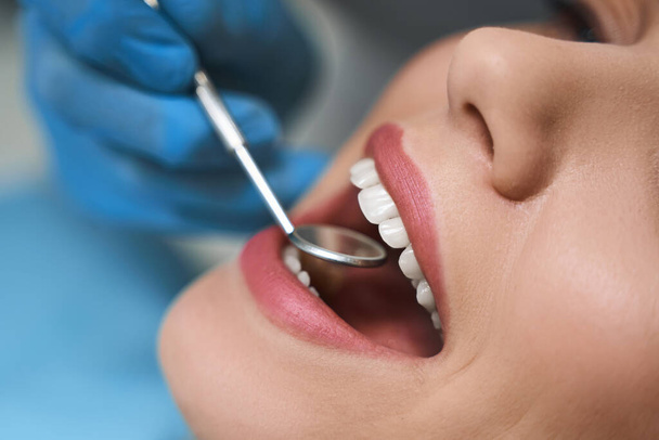 Dentist is examining young woman stock photo - 写真・画像