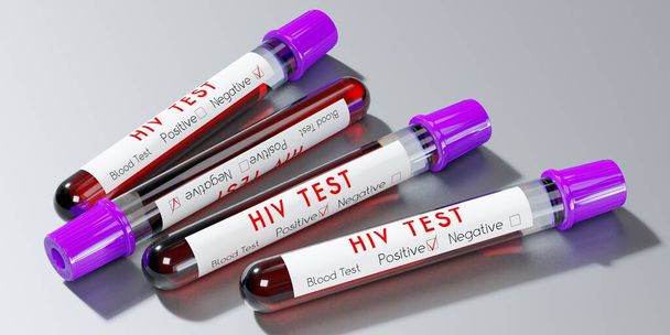HIV virus/ AIDS - test tubes, blood tests - 3D illustration - Foto, Imagem