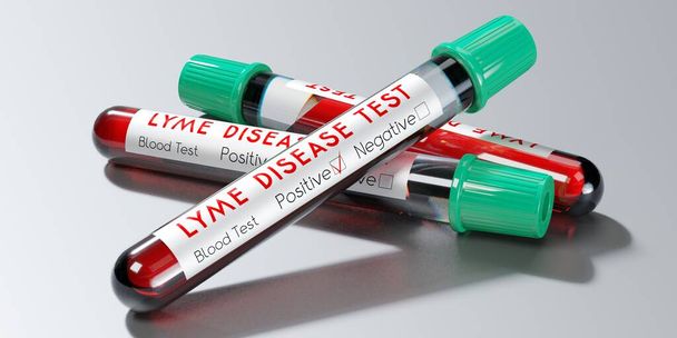 Virus de la enfermedad de Lyme - tubos de ensayo, análisis de sangre - Ilustración 3D
 - Foto, Imagen