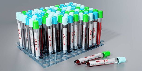 HIV virus / AIDS - zkumavky, krevní testy - 3D ilustrace - Fotografie, Obrázek