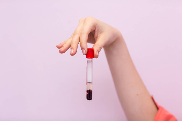 Asistente de laboratorio en laboratorio médico sostiene tubo de ensayo con sangre y plasma en la mano y haciendo análisis
. - Foto, imagen