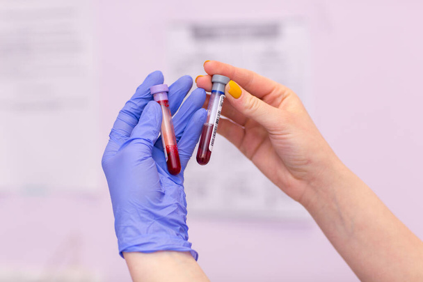 Laboratorioassistentti lääketieteellisessä laboratoriossa pitää koeputkea, jossa on verta ja plasmaa kädessään ja tekee analyysejä
. - Valokuva, kuva