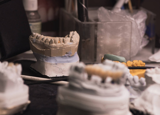 gips modellen van de menselijke kaak, tandprothesen. Bureau tandtechnicus - Foto, afbeelding
