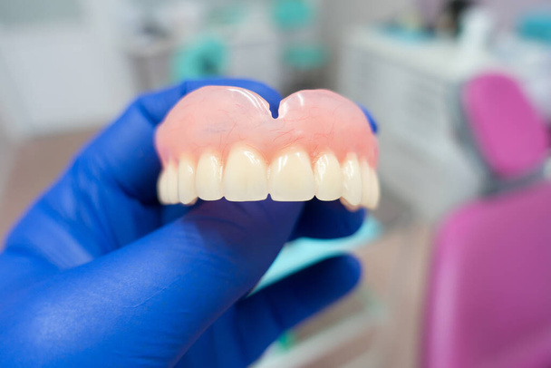prótesis dentales extraíbles en las manos de un médico con guantes azules
 - Foto, Imagen