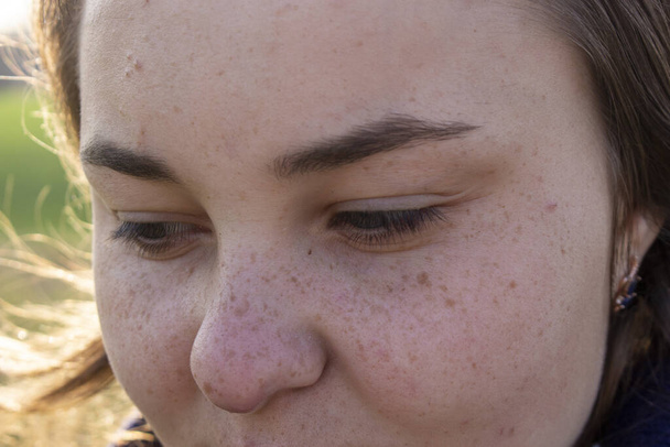 Freckles la face without makeup in a young girl. - Photo, Image