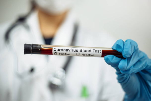 Dokter vrouw met chirurgisch masker met een bloed reageerbuis positief Coronavirus, geïsoleerd op grijze achtergrond. Vrouwelijke verpleegster houdt nCov2019 bord vast. Covid-19 en ziektepreventie - Foto, afbeelding