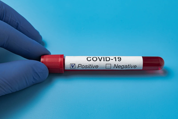 Dokter met buis van biologisch monster besmet met Coronavirus. Label Covid-19. Analyse van nCoV 2019. - Foto, afbeelding