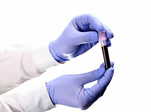 A young doctor, laboratory practitioner, with medical gloves, holding a test tube with blood sample on a white background. Coronavirus pandemic, epidemic. Corona virus. - Photo, Image