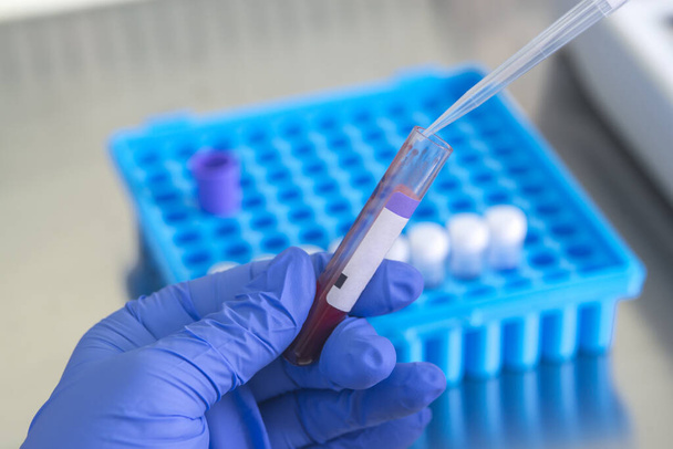 Doctor holding blood tube test in the research laboratory.Corona virus pandemic concept.Coronavirus vaccine development - Foto, afbeelding