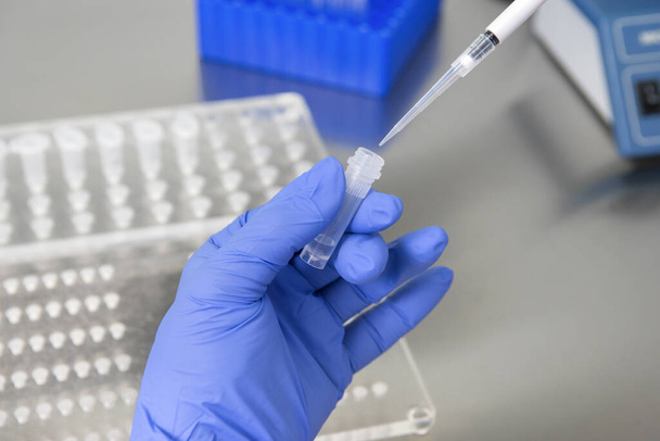 Ученый, работающий с образцом крови в лаборатории, получил результаты анализа крови для разработки новой быстро распространяющейся коронавирусной вакцины
 - Фото, изображение