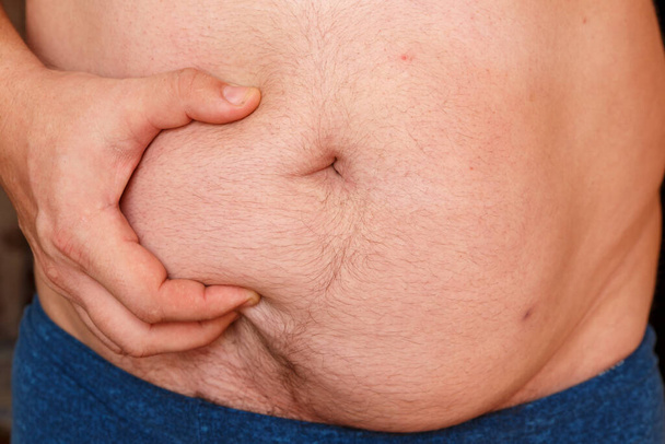 Un hombre sostiene su estómago con su mano y muestra su grasa
. - Foto, imagen