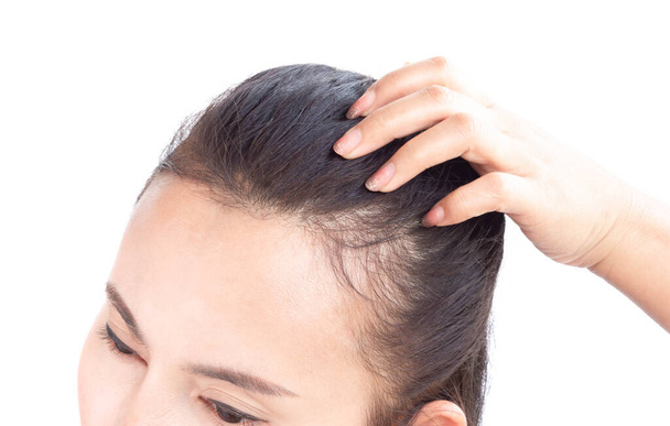 Женщина серьезная проблема выпадения волос для здоровья шампуня и косметики концепция продукта, избирательный фокус - Фото, изображение