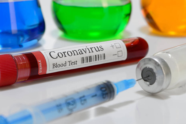 COVID-19 test and laboratory sample of blood testing for diagnosis coronavirus infection and vaccine - Photo, image