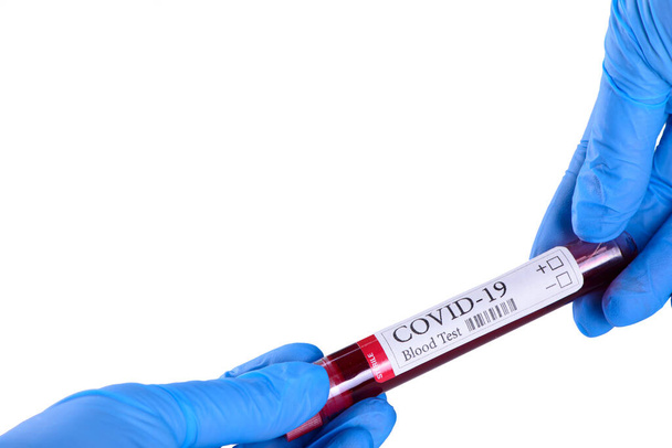 COVID-19 test e campione di laboratorio di esami del sangue per la diagnosi di infezione coronavirus nelle mani dell'assistente di laboratorio su sfondo bianco e spazio per il concetto di annunci
 - Foto, immagini