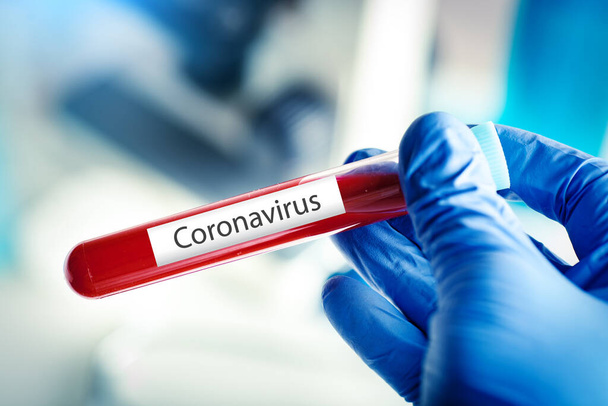Coronavirus in Lab. Scientist hold Blood Test. New Epidemic Coronavirus 2019 nCoV. Background with copy space. - Фото, зображення