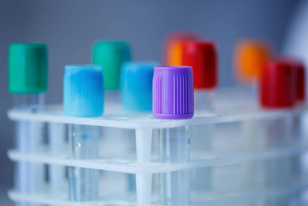 Test tubes for blood analysis. Check for the virus. Medical Devices - Photo, Image