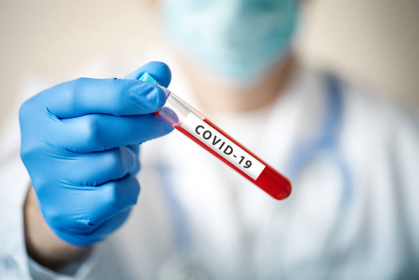 Coronavírus no Laboratório. O cientista faz análises ao sangue. Nova Epidemia Coronavirus 2019 nCoV. Fundo com espaço de cópia
. - Foto, Imagem