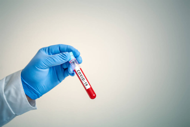 Coronavirus in Lab. Scientist hold Blood Test. New Epidemic Coronavirus 2019 nCoV. Background with copy space. - Zdjęcie, obraz