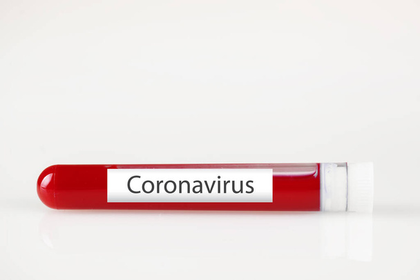 Test tube with blood and white sticker on white. Background with copy space. Coronavirus. Horizontal. - Foto, Bild