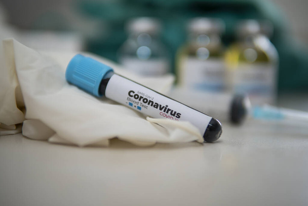 Positive COVID-19 test and laboratory sample of blood testing for diagnosis new Corona virus infection(novel corona virus disease 2019) with hospital background. Pandemic infectious concept - Φωτογραφία, εικόνα