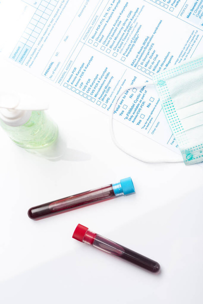 コロナウイルスの存在のための血液検査サンプル(COVID-19)患者からの血液サンプルを含むチューブ. - 写真・画像