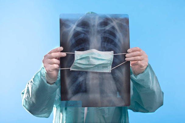 Vědec, mikrobiolog nebo lékař kontrolující virovou infekci nebo plicní léze na rentgenovém snímku hrudníku v nemocnici. Lékař vyšetřuje plicní radiografii koronavirus covid 19 nemoc virus infikovaný pacienta laboratorní zprávu - Fotografie, Obrázek
