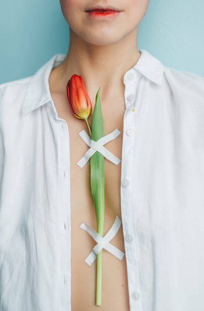 Body of female cancer patient with red tulip. Fighting with cancer. Closeup view - Valokuva, kuva