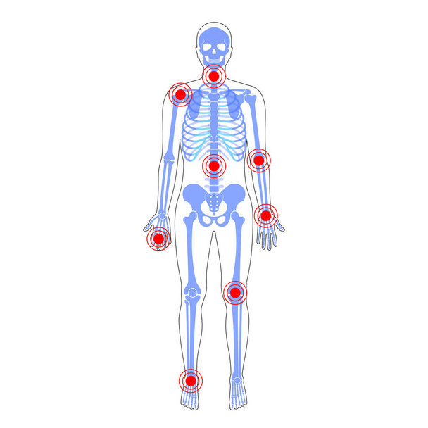 Joint pain on skeleton in human body - Vector, Image
