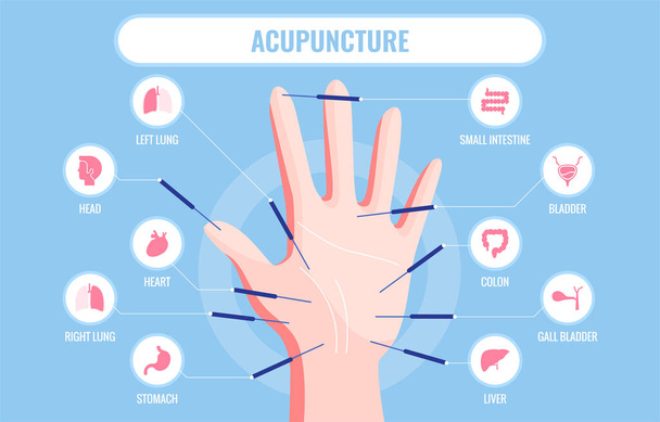 Vector illustration of traditional Chinese acupuncture medicine - Vector, Image