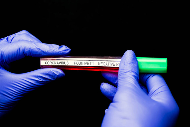 Manos en guantes azules tubo de prueba de pañal con coronavirus resultado sobre fondo negro
 - Foto, Imagen