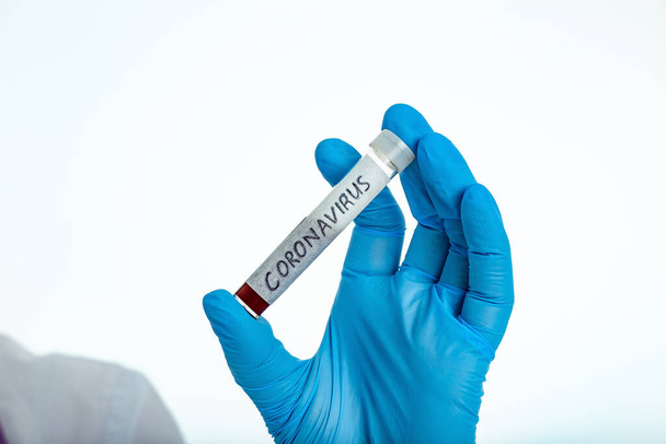 A nurse s hand in a glove holds a test tube with the inscription COVID 19, with a positive blood test for a new rapidly spreading coronavirus, close-up, shallow depth of field, selective focus - Foto, Bild