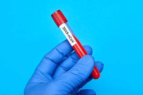 Coronavirus - inscription on a test tube with blood in hand in a rubber glove on a blue background. - Fotoğraf, Görsel
