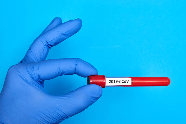 Coronavirus - inscription on a test tube with blood in hand in a rubber glove on a blue background. - Foto, Bild