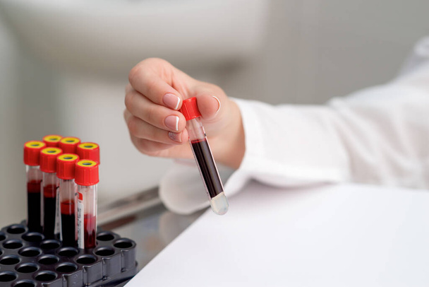 Arzt entnimmt Blutkonserven aus Tablett auf dem Tisch. - Foto, Bild