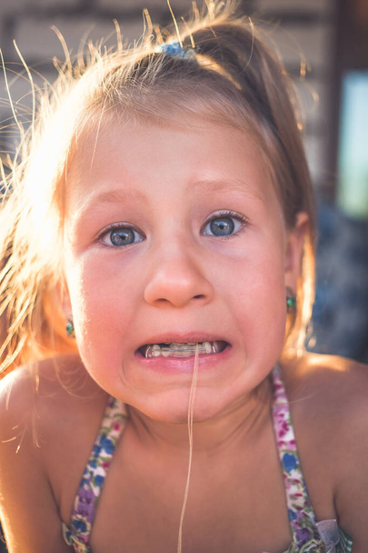 Le processus d'enlèvement d'une dent de bébé à l'aide d'un fil. - Photo, image