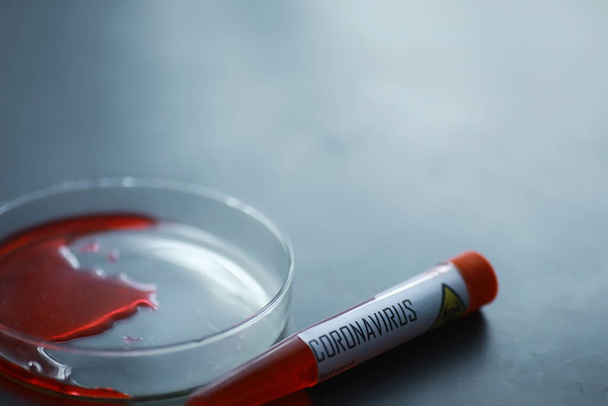Uma amostra de sangue para testar o perigoso vírus coronavírus no corpo. Tubos de ensaio com testes para o coronavírus. Estudos laboratoriais de doenças virais. - Foto, Imagem