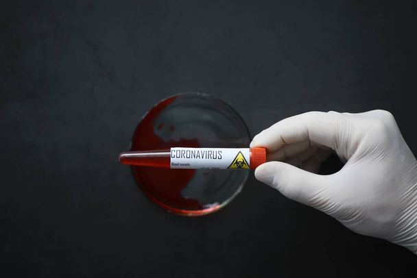 A blood sample for testing the dangerous virus coronavirus in body. Test tubes with tests for coronavirus. Laboratory studies of viral diseases. - 写真・画像