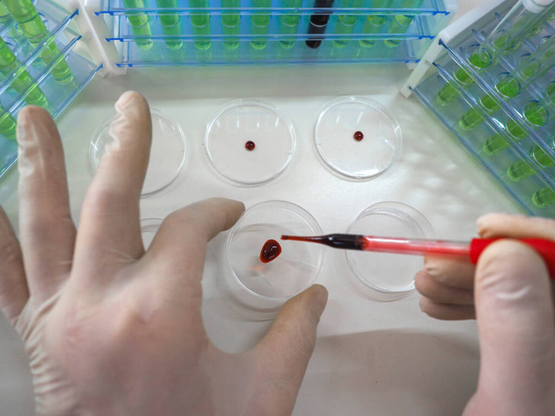 Photo of a pipette in a researchers hands dripping a blood sampe in a Petri sish. Vaccine creation. - Photo, Image