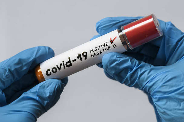 Mains dans les gants de protection bleus avec éprouvette avec résultat positif coronavirus infecté COVID 19
. - Photo, image