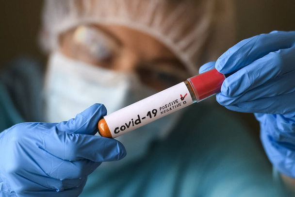 Γυναίκα σε προστατευτική στολή κρατήστε σωλήνα δοκιμής με θετικό αποτέλεσμα που έχει μολυνθεί με coronavirus COVID - 19. Εικονογράφηση. - Φωτογραφία, εικόνα