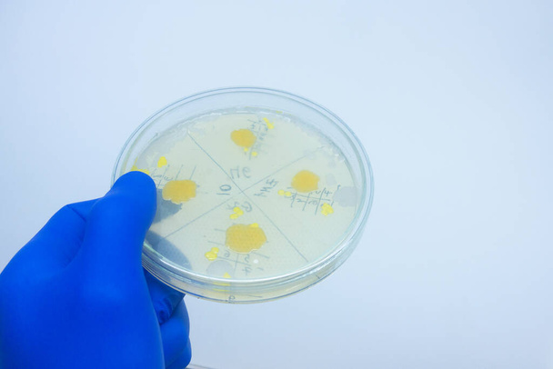 Bilim adamı elinde bakterili bir petri kabı tutuyor.. - Fotoğraf, Görsel