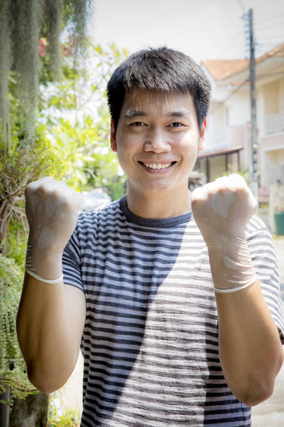 asiático hombre usando goma mano guante toothy sonriendo cara al aire libre
 - Foto, Imagen