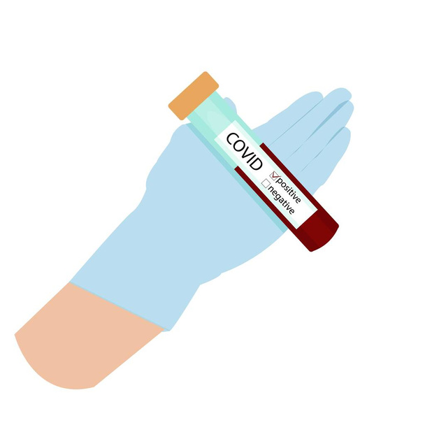 Pruebas de laboratorio y hospitalarias muestra de sangre. informe de resultados de Positive of coronavirus Covid-19. Guante de mano sosteniendo tubo de prueba. Test n-CoV-2019 Concepto
 - Vector, imagen
