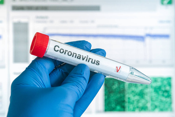 コロナウイルス検査またはCOVID-19検査。手袋の手は、コロナウイルステストラベル付きの試験管を保持しています。背景の解析データ。SARS-CoV-2試験コンセプト. - 写真・画像