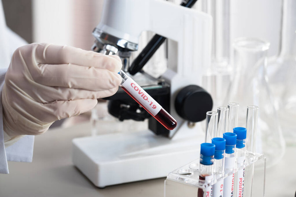 Sestřička drží zkumavku s krví pro analýzu nCoV-2019, koncepce koronavirového testu v laboratoři - Fotografie, Obrázek